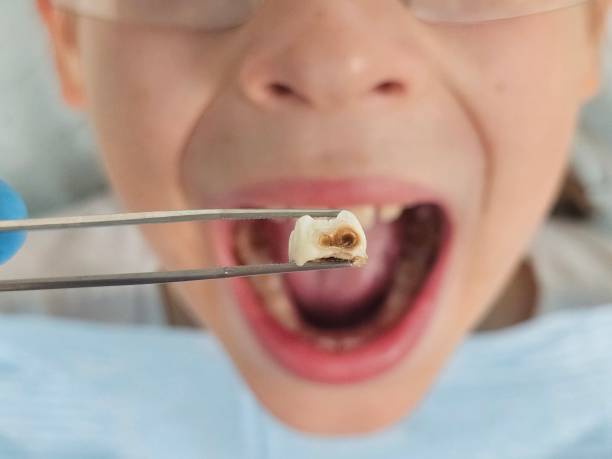 Best Tooth Infection Emergency Dentist  in Albertville, MN